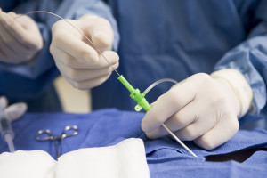 Minimally invasive surgery